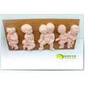 ANATOMY14(12452) Demonstrator Deformities in Infants ,8 pieces in a Series, Anatomy Models > Fetal Malformation Model 12452